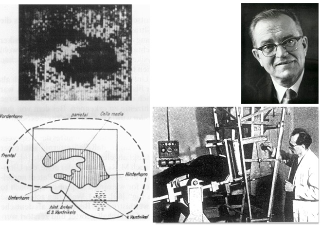 Karl Dussik's impressive prototype of the ultrasound scanner for the brain