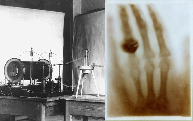 Left: Wilhelm Conrad Röntgen x-ray machine. Right: First x-ray picture Left: Wilhelm Conrad Röntgen x-ray machine. Right: First x-ray picture